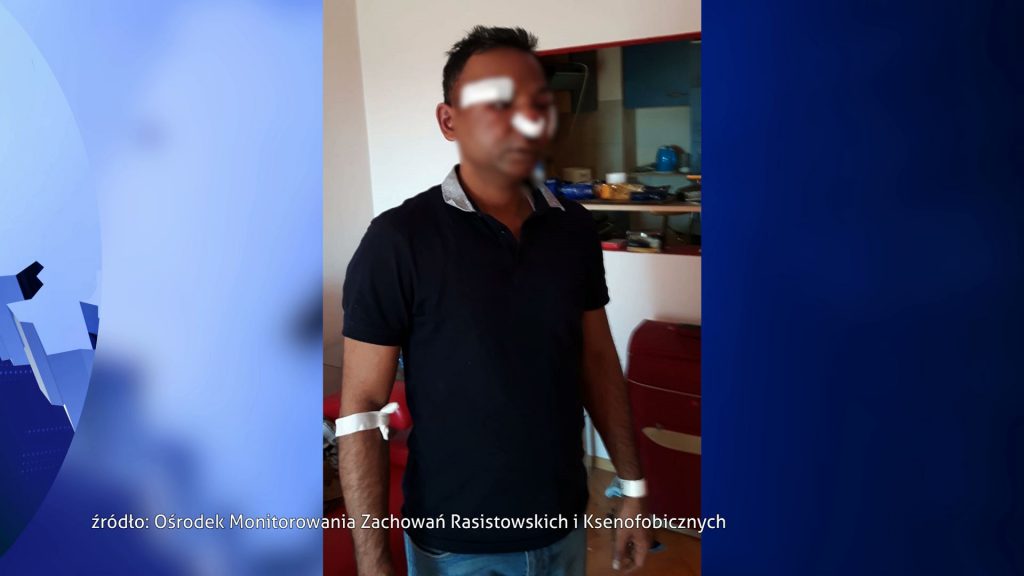 Dąbrowa Górnicza: Pseudokibice Zagłębia Sosnowiec skatowali obywatela Bangladeszu?