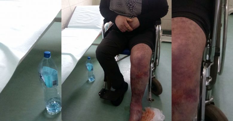 Śląskie: Szpitale płacą za śmierć pacjentów na SORach. Rzecznik Praw Pacjenta na placówkach nie zostawia suchej nitki!