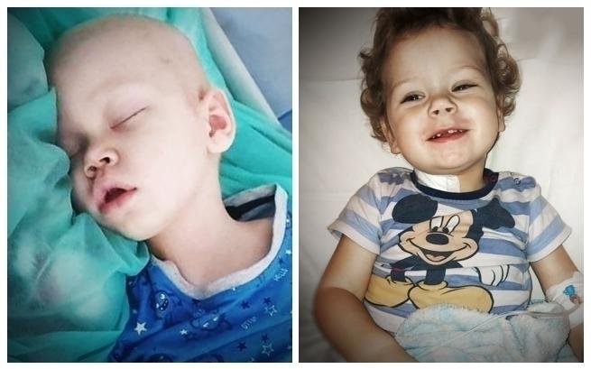 Mały Marcelek z Piekar Śląskich walczy z neuroblastomą IV stopnia. Trzeba zebrać prawie 2 miliony złotych. Fot. archiwum prywatne rodziców Marcela