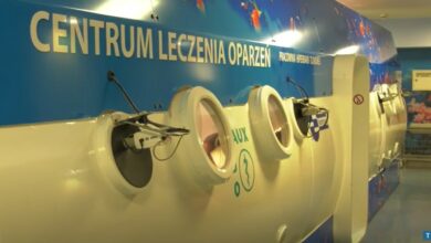 Centrum Oparzeń Siemianowice. Komora hiperbaryczna