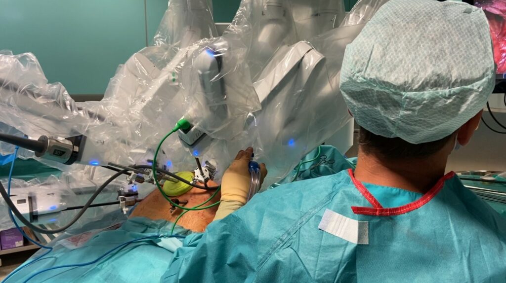 operacja robot da Vinci