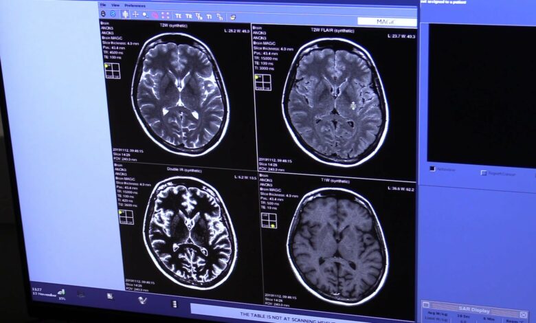 Parkinson. Jak żyć z tą chorobą?